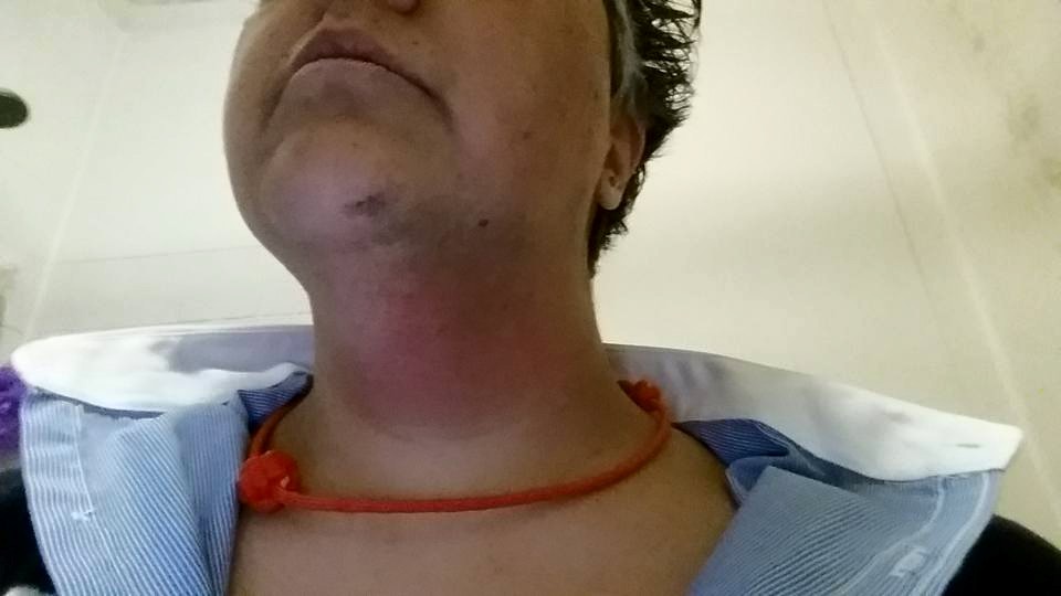 Homofobia: Portuguesa Atacada Em&nbsp;Londres