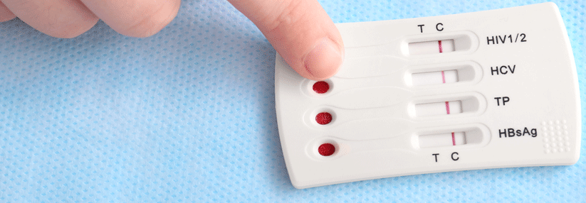 Novos Casos de Infecção por VIH voltam a descer em&nbsp;Portugal