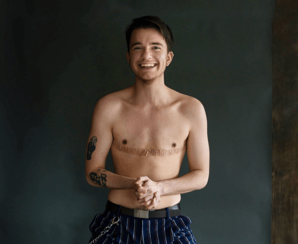 Saúde: Estudo mostra altos níveis de satisfação de pessoas trans após mastectomia de afirmação de género