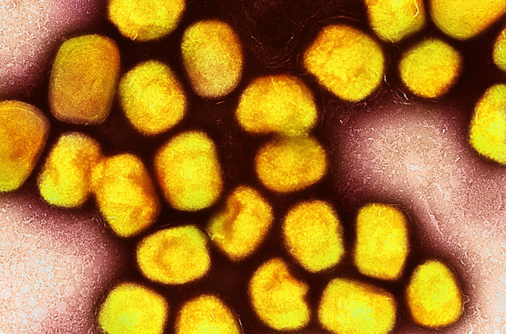 Nova variante de Mpox surge na Europa: expansão mais contagiosa e perigosa preocupa&nbsp;especialistas